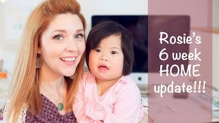 Rosies 6 week UPDATE  China Adoption Story [upl. by Bolan]