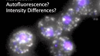 Fluorescence In Situ Hybridization FISH Review [upl. by Etnomal]