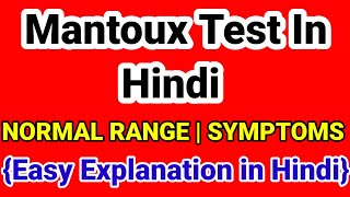 Mantoux Test in hindi  Tuberculosis Detection test  In Hindi [upl. by Arretal829]