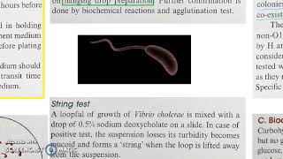 Microbiology 228 a Vibrio cholerae Cholera Lab Diagnosis [upl. by Nnanaej]