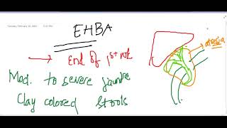 extrahepatic biliary atresia  Pediatrics [upl. by Eerrehs]