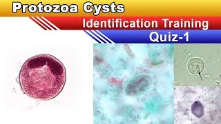 Protozoa Cysts Identification Training Quiz  Part 1 [upl. by Nylcoj]