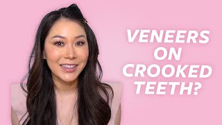 Can You Put Veneers on Crowded and Crooked Teeth Dentist Explains  Dr Joyce Kahng [upl. by Garett]