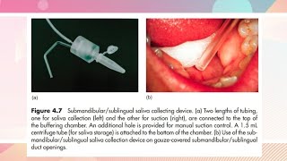 Saliva  Structure of glands  Physiology  Functions  Methods of collection  Salivary diagnostics [upl. by Hoy]