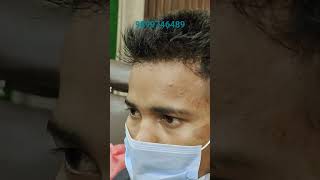 Natural look Hair Patches Men  Hair Patch in Delhi  viral reels tiktok shorts fashion wigs [upl. by Meagan190]