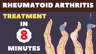 Rheumatoid Arthritis Treatment  New Medicines and Updates [upl. by Akienaj]