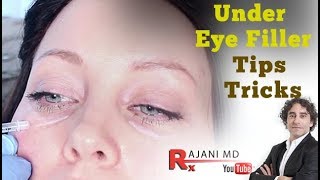 Watch Under Eye FillerTips and Tricks Portland Oregon Restylane Juvederm and PRF Injections [upl. by Nordine]