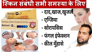 मात्र 5 दिन मे दाद खाज खुजली जड़ खत्म ।। dad khaj khujali ki dava ।। Betzee gm cream uses Hindi [upl. by Novaat]