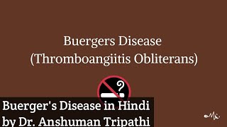 Buergers Disease in Hindi Language ☺️😊👍 [upl. by Darrel]