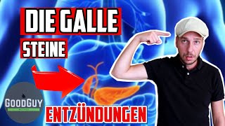 Die GalleGallensteineSchmerzen und deren Ursache [upl. by Zuzana]