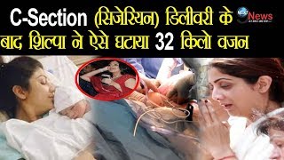 CSection में हुआ था शिल्पा शेट्टी के बच्चे का जन्म रुला देगा सिजेरियन Delivery का दर्द [upl. by Annaillil]