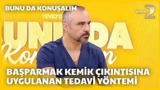 teve2de Bunu da Konuşalım  quotKireçlenme Rahatsızlığında Da Kemik Çıkıntısı Ortaya Çıkabilirquot [upl. by Afnin]