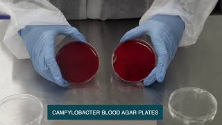 Unveiling Microbial Growth Revealing Microbial Growth on Various Agar Media [upl. by Vail]