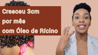 O QUE NÃO TE CONTARAM SOBRE ÓLEO DE RÍCINO NO CABELO [upl. by Sylram]