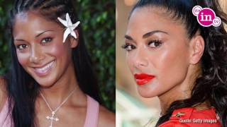 War Nicole Scherzinger beim BeautyDoc [upl. by Eitsud]