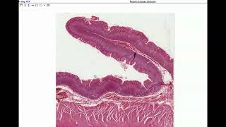 Anatomy  Histology of the Stomach amp Small Intestine [upl. by Hubbard]