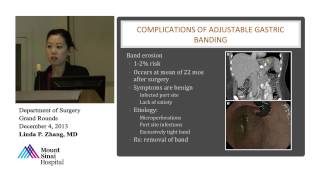 Revisional Bariatric Surgery How Bad Can It Be [upl. by Larimore]