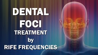 Dental Foci  RIFE Frequencies Treatment  Energy amp Quantum Medicine with Bioresonance [upl. by Zelazny]