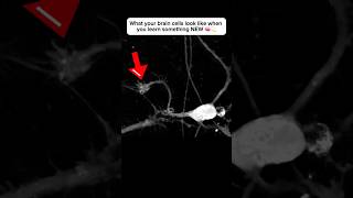 Brain cell restructures itself after forming a new connection neuroplasticity neuroscience brain [upl. by Fesuoy537]