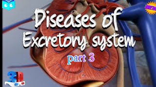 Excretory System Diseases Understanding the Impact on our Health  Class 11 Biology neet biology [upl. by Hennebery468]