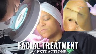 FACIAL WEXTRACTIONS  ESTHETICIAN  SKINCARE facial extractions skincareroutine esthetician [upl. by Ayyidas339]