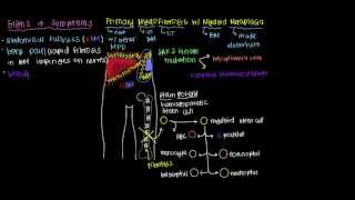 What is primary myelofibrosis [upl. by Aramoy548]