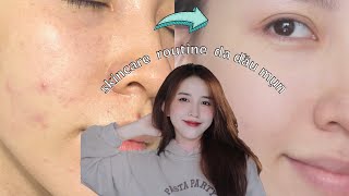 ROUTINE SKINCARE TỐI GIẢN CHO DA DẦU MỤN Mỹ phẩm Việt HERBARIO có tốt không [upl. by Nnaeerb723]