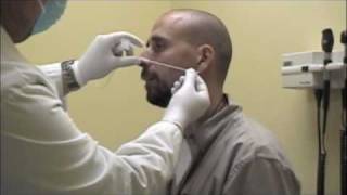 Procedure for Nasopharyngeal Swabs and Aspirates [upl. by Pryor]