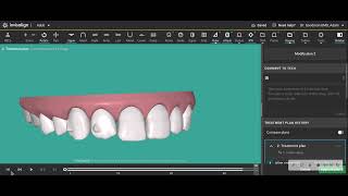 Making Invisalign clinchecks produce more predictable movements [upl. by Elsbeth520]