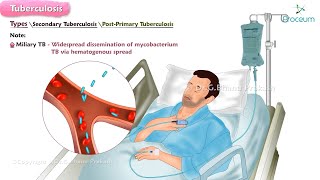 Tuberculosis🫁🦠  Microbiology  Clinical features  Diagnosis  Treatment [upl. by Abdel]