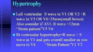 ECG Course 1 [upl. by Eded]