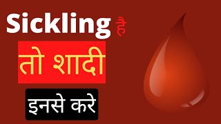 Sickling है तो शादी इनसे करे।Sickle cell anemia [upl. by Haerle]