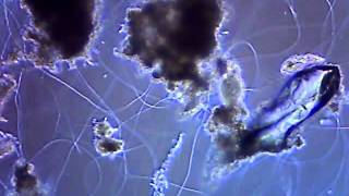 One drop of wastewater in a microscope [upl. by Osmund]