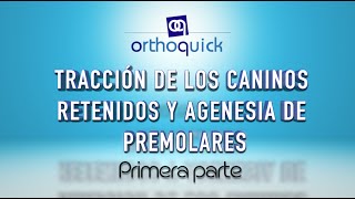 TRACCIÓN DE LOS CANINOS RETENIDOS Y AGENESIA DE PREMOLARES PRIMERA PARTE [upl. by Cinelli]