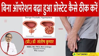 प्रोस्टेट का साइज कैसे कम करें How to Reduce Prostate Size Without Surgery [upl. by Mariele787]