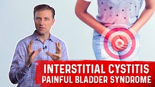 What is Interstitial Cystitis Painful Bladder Syndrome – Symptoms amp Remedy Covered by DrBerg [upl. by Bibby]