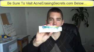 Is Zinc The The Cure For Acne  Zinc Acne Cure Treatment [upl. by Durwood]