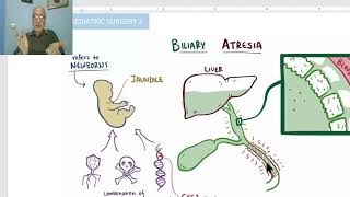 Paediatric surgery in Arabic 13  Biliary Atresia  by Dr Wahdan [upl. by Darreg]