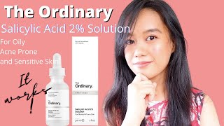 What to use after The Ordinary Salicylic acid 2 Solution Review PS IT WORKS [upl. by Gervais228]