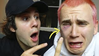 I GOT A BLACK EYE ft David Dobrik [upl. by Brand]