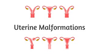 Uterine Malformations  Embryology  Gynecology  High Yield  USMLE  NEET PG  INICET [upl. by Park]