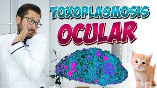 ⛔️Tú GATO puede dejarte CIEGO l ¿Sabes que es la TOXOPLASMOSIS Ocular  ⛔️ [upl. by Otreblanauj]