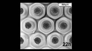 Mesenchymal Stem Cell spheroid formation time lapse [upl. by Ruby]