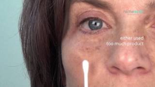 Tutorial What to do if you see some white residue after using Remescar Eye Bags amp Dark Circles [upl. by Eerahc620]