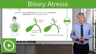 Biliary Atresia – Pediatrics  Lecturio [upl. by Guillaume634]