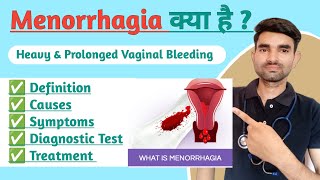 Menorrhagia in Hindi  Causes Symptoms And Treatment of Menorrhagia [upl. by Eedyaj]