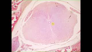 Interneuron sensory neuron pseudounipolar neuron ependymal cells satellite cells Spinal cord amp g [upl. by Linneman777]