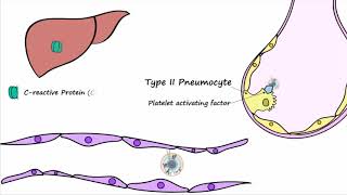 Bacterial Pneumonia  Pathogenesis [upl. by Colene]