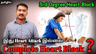 Complete Heart Block in tamil  3rd Degree Heart block  causes and symptoms of CHB PS PStamil [upl. by Zipporah]