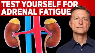 How To Test Yourself For Adrenal Fatigue – Dr Berg On Adrenal Insufficiency [upl. by Rebba559]